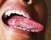 What Your Tongue And Tonsils Could Tell You About Your Sleeping Habits